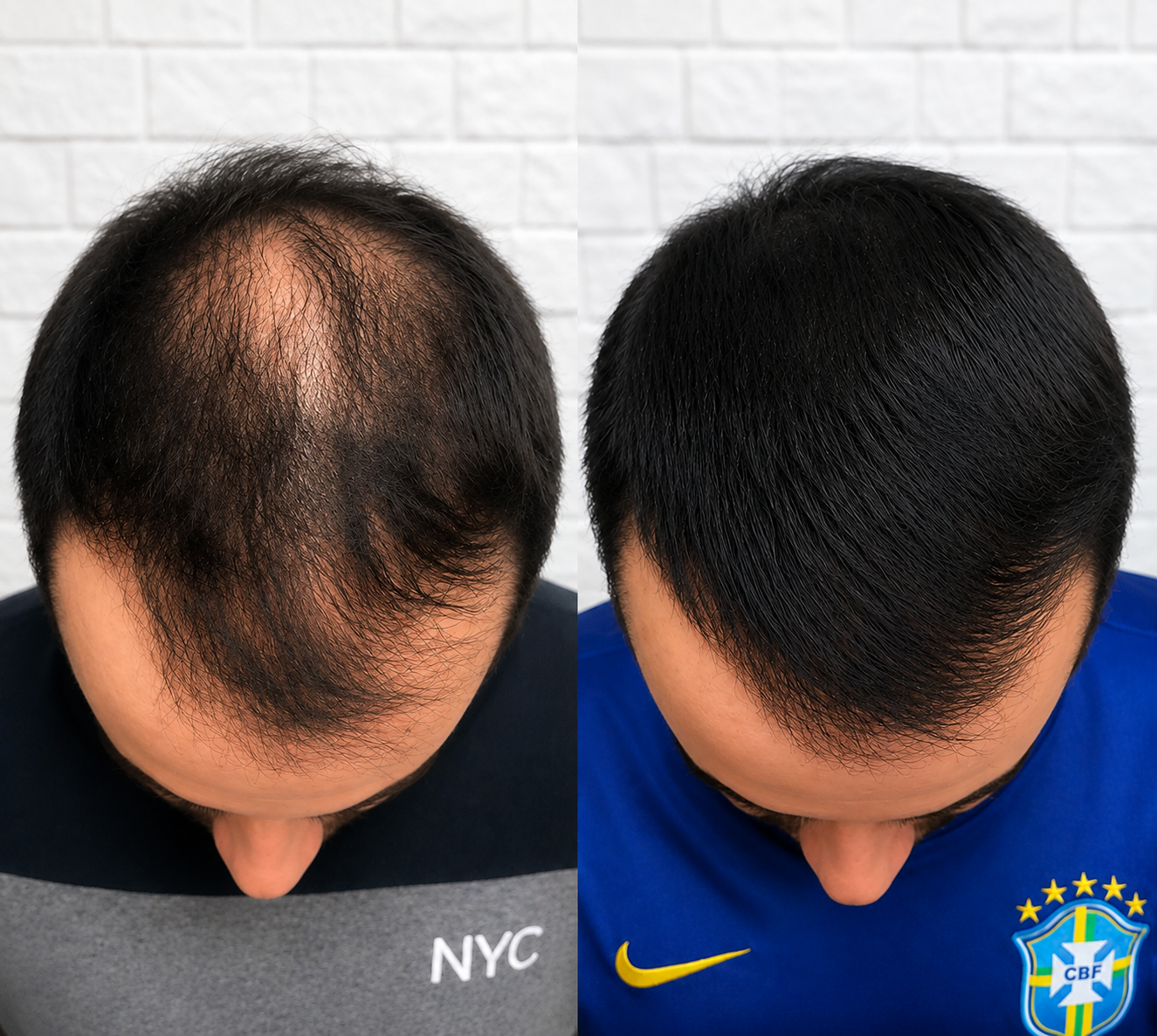 Terapias Capilares